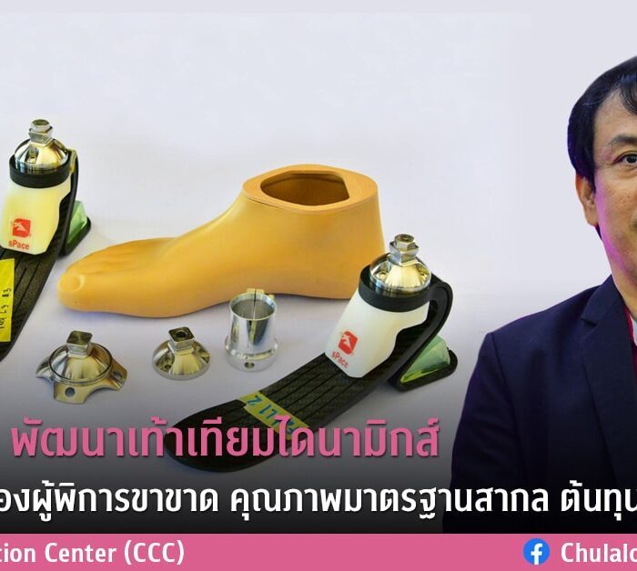 วิศวกรรมศาสตร์ จุฬาฯ พัฒนาเท้าเทียมไดนามิกส์